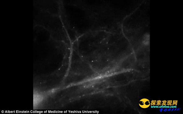 美科学家捕捉到老鼠大脑记忆形成的过程