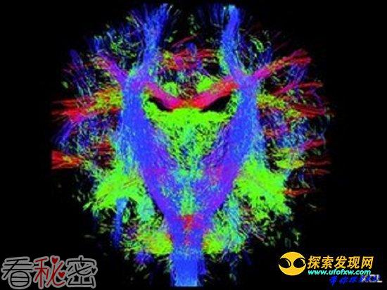 英科学家将绘制婴儿出生前后的神经发育图