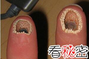 超恶心的空手指是什么，将七鳃鳗嘴巴P在手指上的恶搞图片