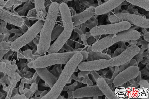 什么细菌最厉害?揭秘世界上十大最强细菌(所向披靡)