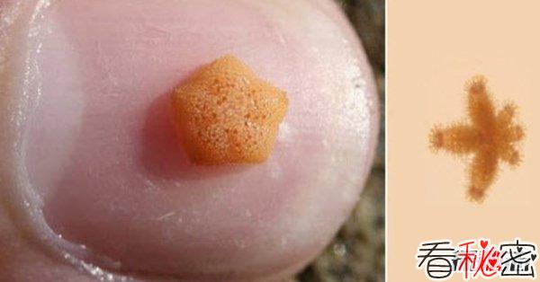 世界体型最小的10大海洋生物 简直不敢想象!(超萌超可爱)