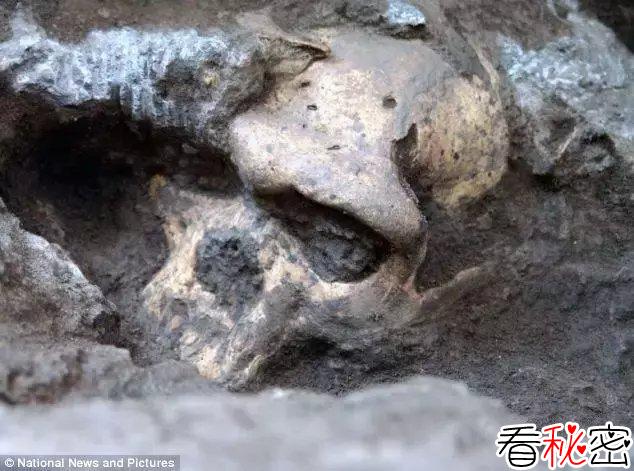 俄罗斯科学家发现, 万年前头骨出现子弹孔?