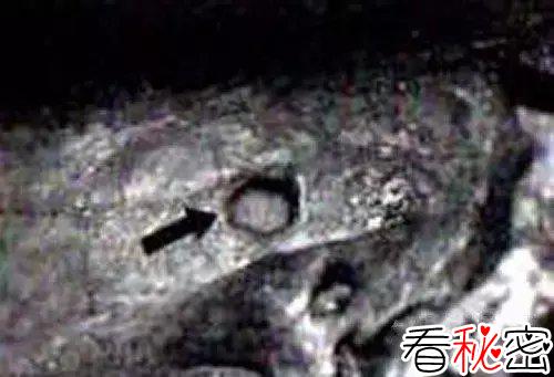 俄罗斯科学家发现, 万年前头骨出现子弹孔?