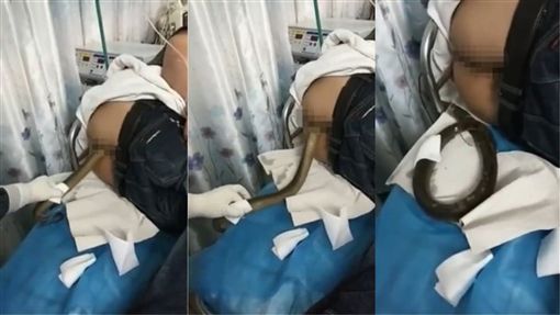 男子下体「条状物」！让护士拉出后　惊叹连连：好大一条啊