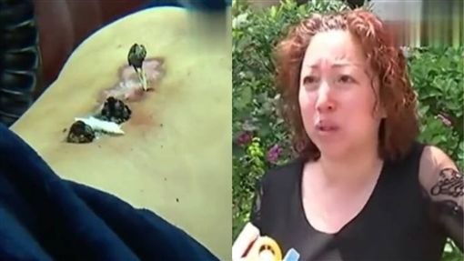 男子听信郎中！花大钱「扎针」治腰痛 结果沦落包尿布