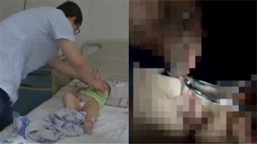 6岁男童把磁铁放生殖器！ 结果惨遭「异极相吸」差点GG