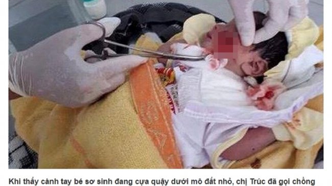 脐带未剪就被活埋 男婴手脚伸出地面幸获救