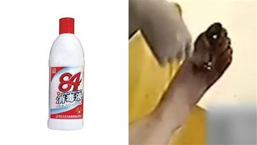 孝顺女用「消毒液」给妈泡脚去脚气！ 结果害母亲恐需截趾