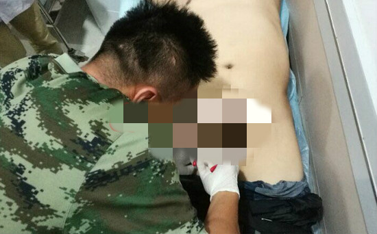 5公分塑胶管自慰卡死还继续充血！消防拆10分钟 他狂抖：尴尬