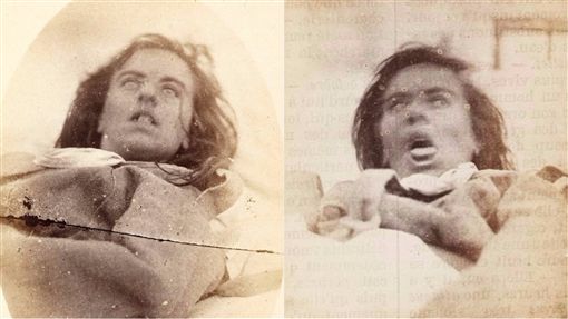 19世纪女性自疗「歇斯底里症」！ 惊悚病照大曝光