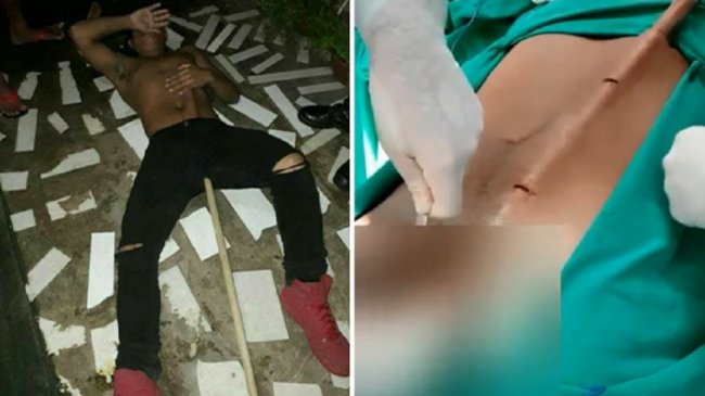 屁股多1根！衰男翻墙逃 遭「扫把插阴囊」贯胸口