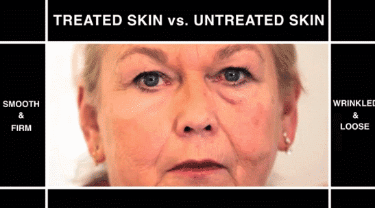 黑科技实验室最新发明:人造皮肤替代拉皮手术