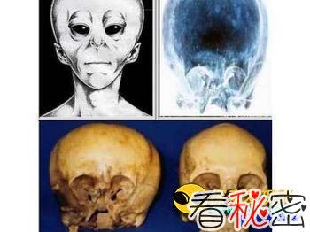 墨西哥神秘头骨 疑外星人和人类混血儿