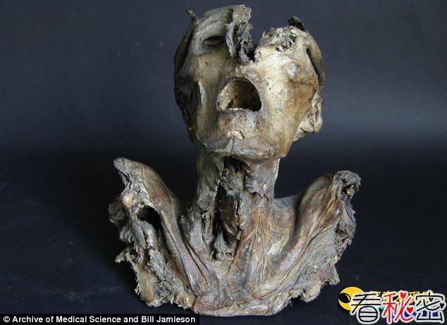 欧洲科学家发现一个古老的前年前干尸头颅