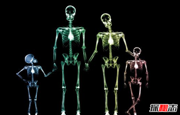 x射线在人体积累多久?长期接触x射线的十大危害