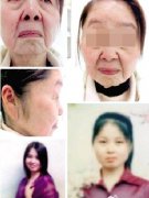 妙龄女分娩后变